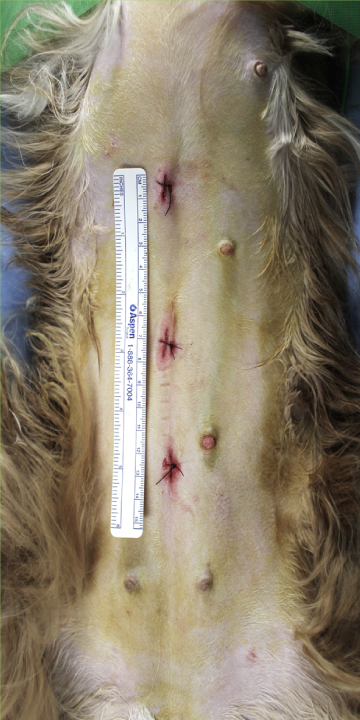 腹腔鏡下避妊手術