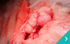 膀胱前立腺摘出