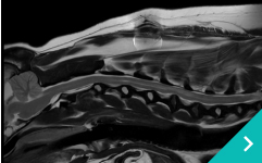 適応している疾患例スロット（腹側減圧術）